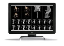 Barco Coronis Fusion 6mp dl - (mdcc-6130) - 30 inch - 6mp - color-lcd Barco Coronis Fusion 6mp dl - (mdcc-6130) - 30 inch - 6mp - color-lcd