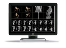 Barco Coronis Fusion 6mp dl - (mdcc-6130) - 30 inch - 6mp - color-lcd - ZONDER adapter Barco Coronis Fusion 6mp dl - (mdcc-6130) - 30 inch - 6mp - color-lcd - ZONDER adapter